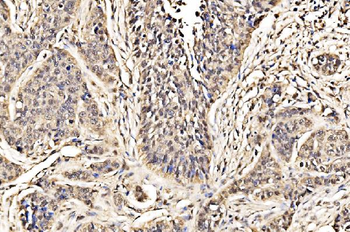 Anti-ADRM1/ARM-1 Antibody
