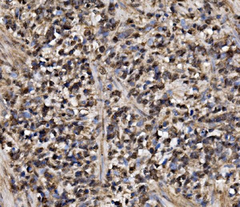 Anti-ADRM1/ARM-1 Antibody