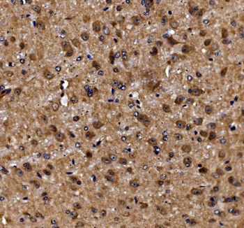 Anti-ADRM1/ARM-1 Antibody