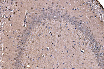 Anti-ADRM1/ARM-1 Antibody