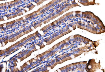 Anti-AGPAT2 Antibody