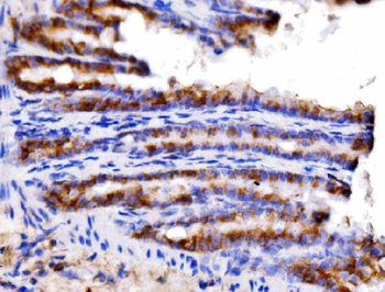 Anti-AGPAT2 Antibody