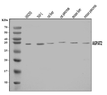 Anti-AGPAT2 Antibody