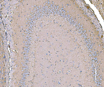 Anti-IRBIT/AHCYL1 Antibody