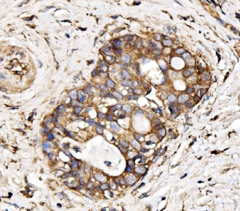 Anti-IRBIT/AHCYL1 Antibody