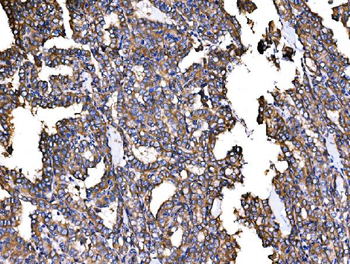 Anti-IRBIT/AHCYL1 Antibody