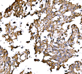 Anti-IRBIT/AHCYL1 Antibody