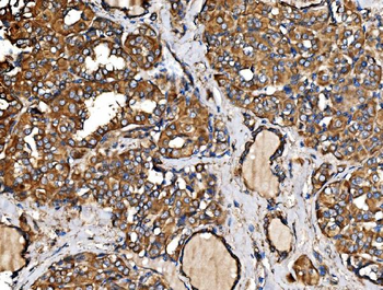Anti-IRBIT/AHCYL1 Antibody