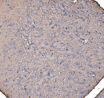 Anti-IRBIT/AHCYL1 Antibody