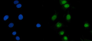ASF1B Rabbit Polyclonal Antibody