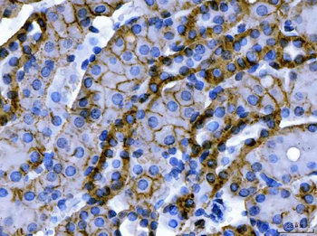 Anti-ATP1B1 Antibody