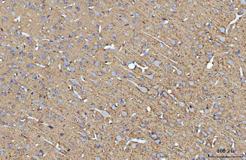 Anti-ATP1B1 Antibody