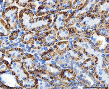 Anti-ATP1B1 Antibody