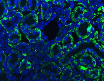 Anti-ATP1B1 Antibody