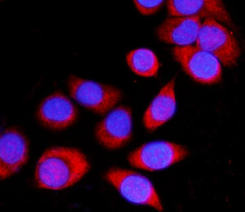 Anti-ATP1B1 Antibody