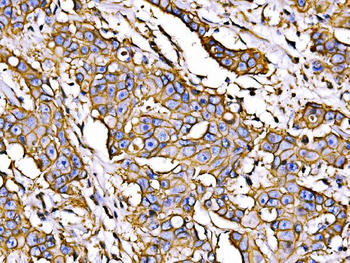 Anti-ATP1B1 Antibody