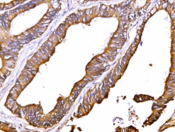 Anti-ATP1B1 Antibody
