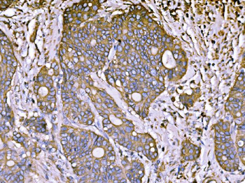 Anti-ATP1B1 Antibody