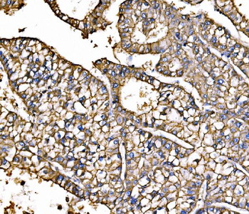 Anti-ATP1B1 Antibody
