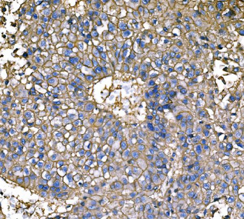 Anti-ATP1B1 Antibody