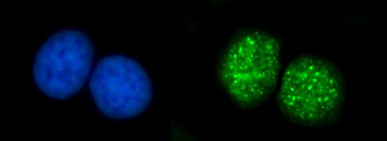 Anti-ATRIP Antibody