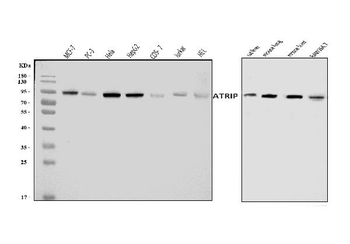 Anti-ATRIP Antibody