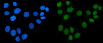 Anti-ACF1/BAZ1A Antibody