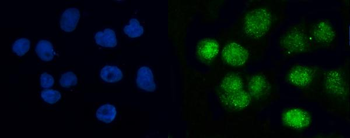 Anti-BRCC36/BRCC3 Antibody
