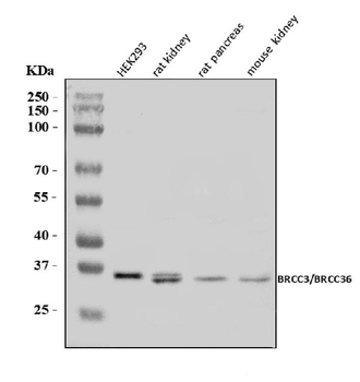Anti-BRCC36/BRCC3 Antibody