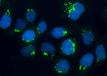 Anti-BRSK1 Antibody