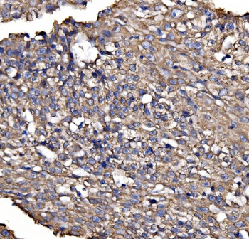 Anti-BRSK1 Antibody