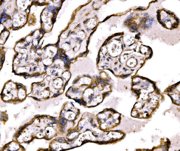 Anti-BRSK1 Antibody