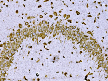Anti-BRSK1 Antibody