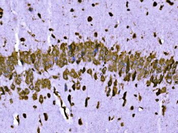 Anti-BRSK1 Antibody