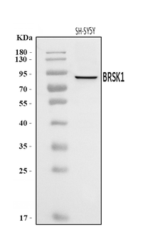 Anti-BRSK1 Antibody