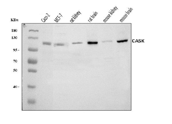 Anti-CASK Antibody