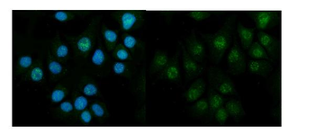 Anti-CBS Antibody