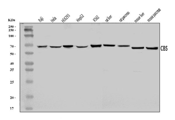 Anti-CBS Antibody