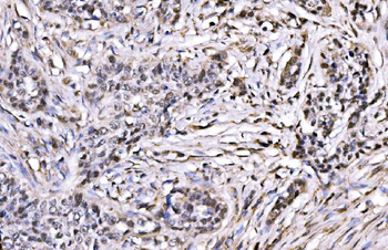 Anti-CBX1/HP1 beta Antibody