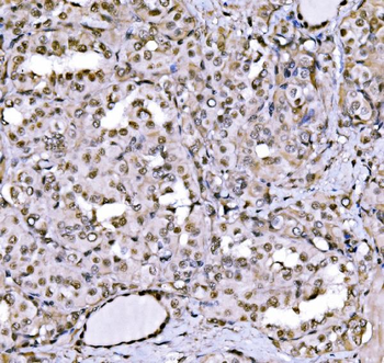 Anti-CBX1/HP1 beta Antibody