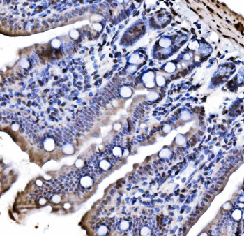 Anti-CBX1/HP1 beta Antibody