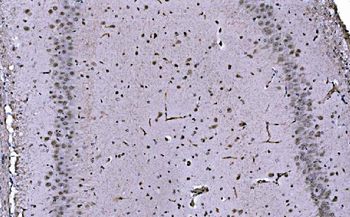 Anti-CBX1/HP1 beta Antibody