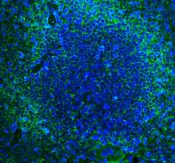 Cd2 Rabbit Polyclonal Antibody
