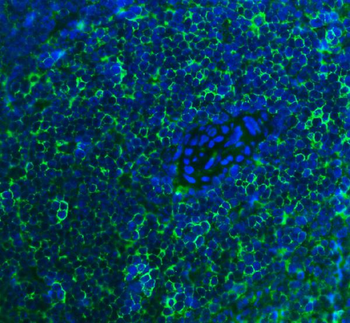 Anti-Cd2 Antibody