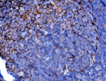 Anti-Cd2 Antibody
