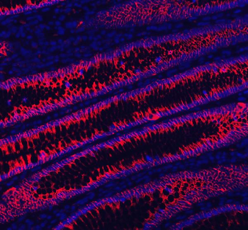 Anti-LI Cadherin/CDH17 Antibody