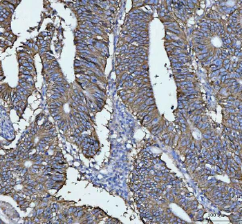 Anti-LI Cadherin/CDH17 Antibody