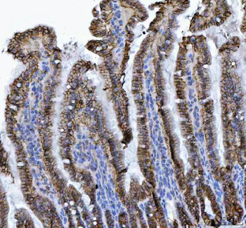 Anti-LI Cadherin/CDH17 Antibody