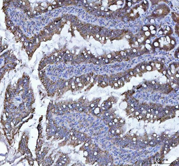 Anti-LI Cadherin/CDH17 Antibody