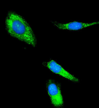 Anti-CLPP Antibody